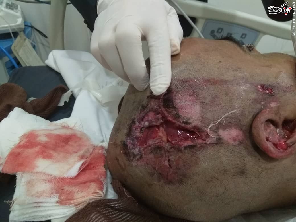 کدزدن واجبتر از جان بیمار است !؟ کدزدن واجبتر از جان بیمار است !؟