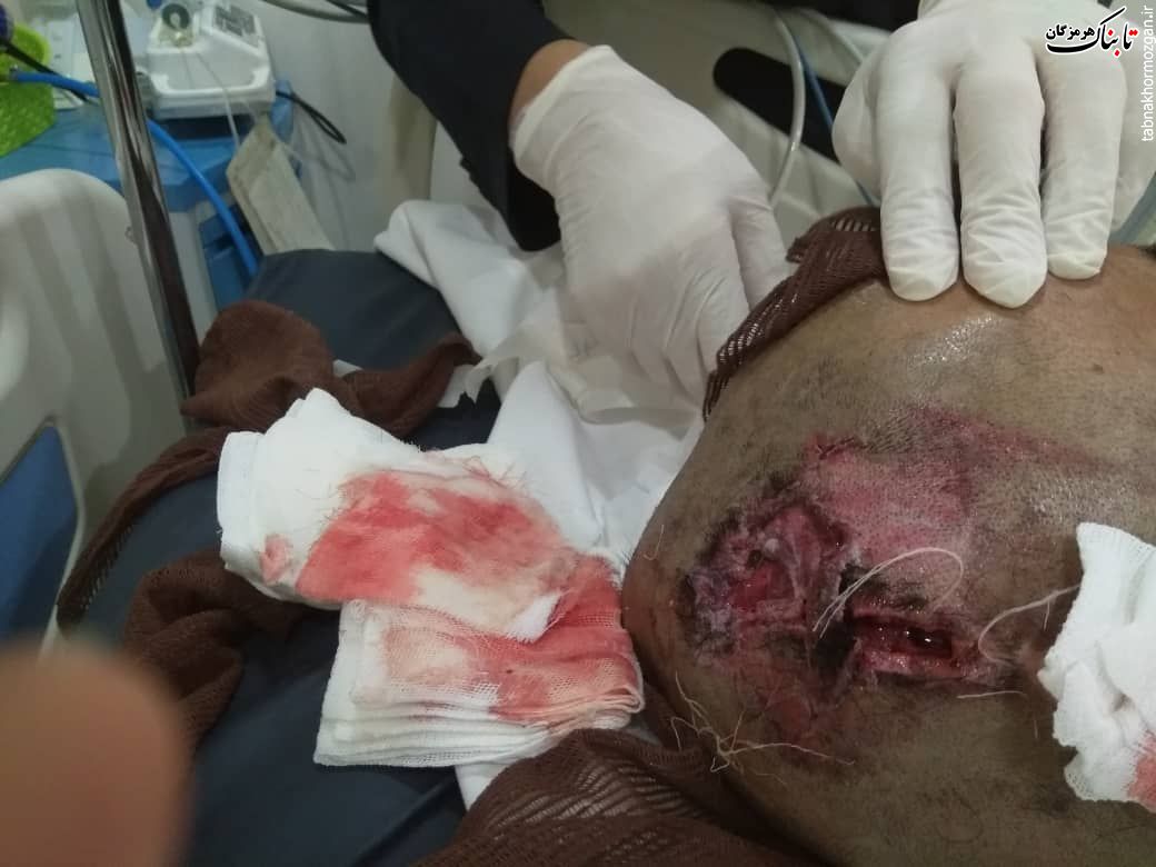 کدزدن واجبتر از جان بیمار است !؟ کدزدن واجبتر از جان بیمار است !؟