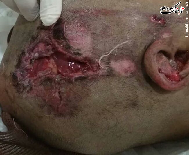 کدزدن واجبتر از جان بیمار است !؟ کدزدن واجبتر از جان بیمار است !؟