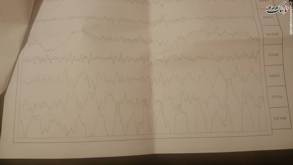 نوار مغزی گران&zwnj;ترین کلاه بر سر بیماران از همه جا بی&zwnj;خبر!