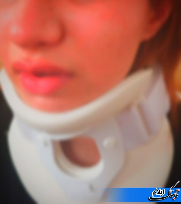 خانم معاون با ضربه ی گوشی ، دانش آموز ایلامی را روانه بیمارستان کرد +عکس