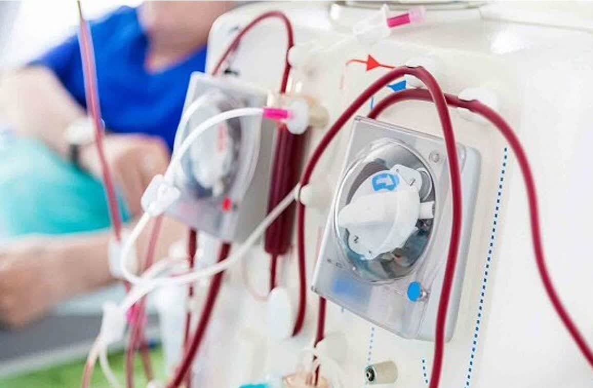 ارتقای خدمات دیالیز هرمزگان با ورود ۸۰ دستگاه جدید